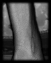 arm1