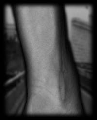 arm2