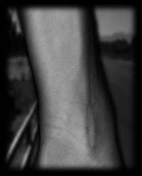 arm3