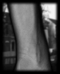 arm4