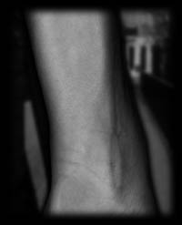 arm5