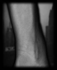 arm6