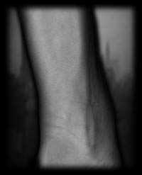 arm7