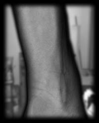 arm8