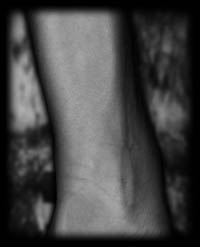 arm10