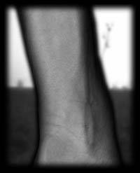 arm11