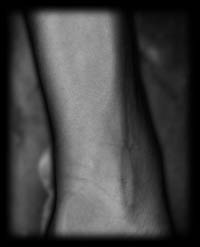 arm12