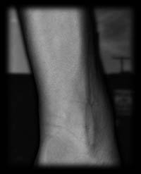arm14