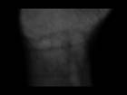 wrist/blur - a closeup of a wrist is visible against a black background